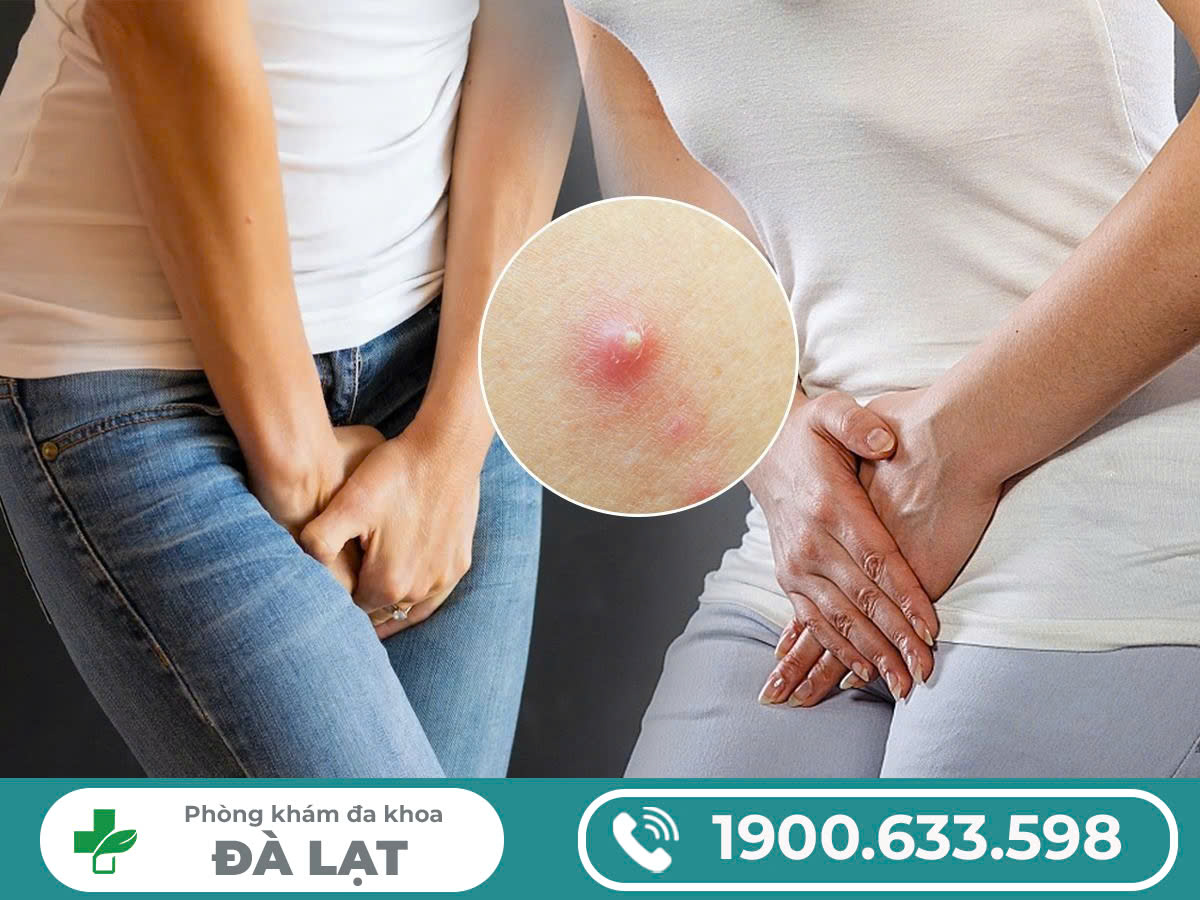 Hình ảnh minh họa